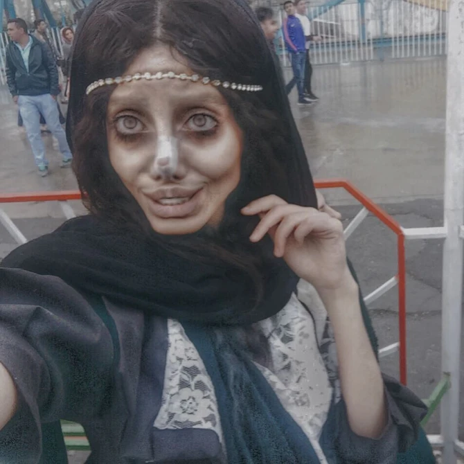 Ancelina Coliyə oxşamaq istəyən 19 yaşlı iranlı qız qorxulu vəziyyətə düşdü (FOTO)