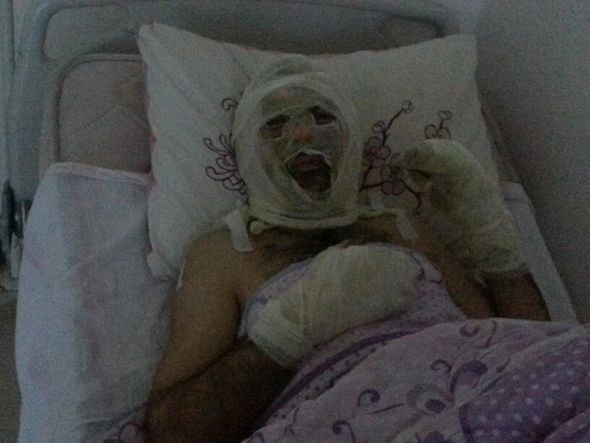 Azərbaycanda kişi yol polisi ilə dalaşıb özünü yandırdı – FOTO