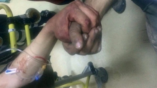 Yaralı türk əsgərlərinin fotosu görənləri göz yaşlarına boğdu (FOTO)