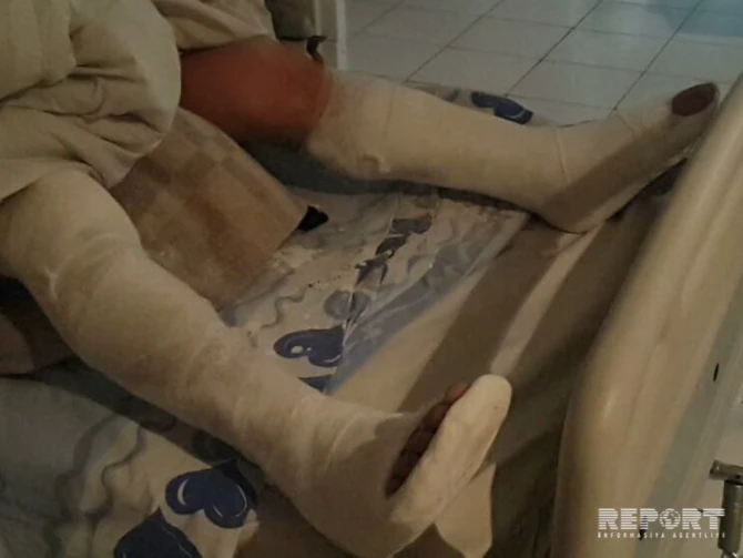 Трагедия в многоэтажном здании в Азербайджане: тяжело пострадали 3 человека (фото)