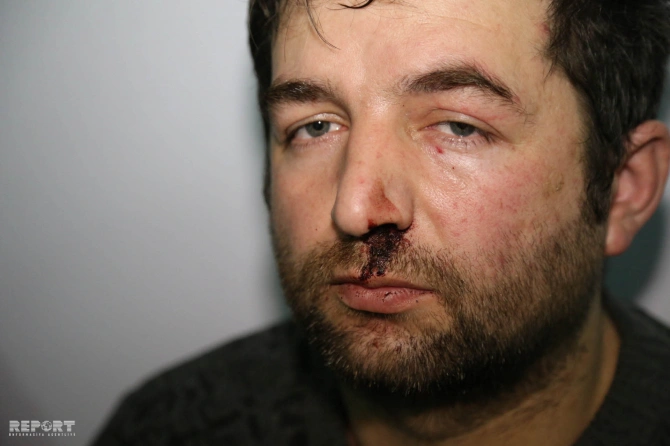 В Баку произошла драка с участием 20 человек, пострадала беременная женщина (фото)