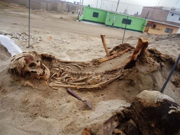 DƏHŞƏT! Uşaqların diri-diri ürəyini çıxardılar – FOTO DƏHŞƏT! Uşaqların diri-diri ürəyini çıxardılar – FOTO