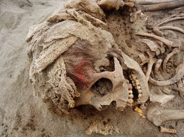 DƏHŞƏT! Uşaqların diri-diri ürəyini çıxardılar – FOTO DƏHŞƏT! Uşaqların diri-diri ürəyini çıxardılar – FOTO