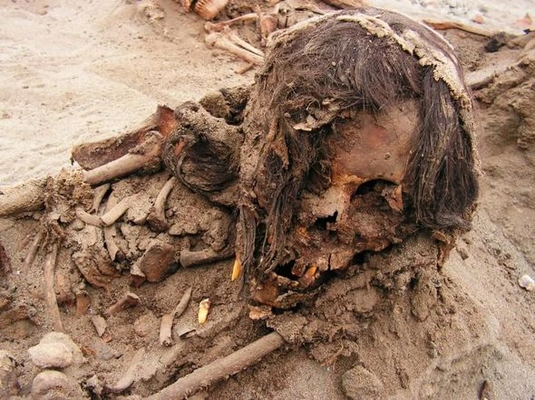 DƏHŞƏT! Uşaqların diri-diri ürəyini çıxardılar – FOTO DƏHŞƏT! Uşaqların diri-diri ürəyini çıxardılar – FOTO