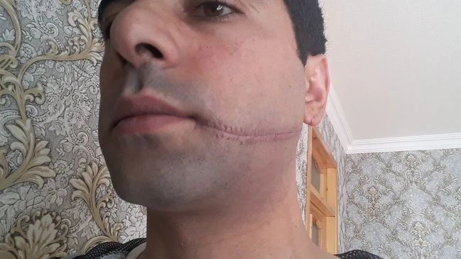 Azərbaycanda DƏHŞƏTLİ CİNAYƏT: 26 yaşlı gəncin ağzını kəsdilər - FOTO