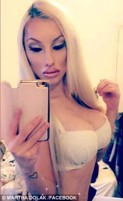 Model sevgilisi tərəfindən vəhşicəsinə döyüldü - FOTO
