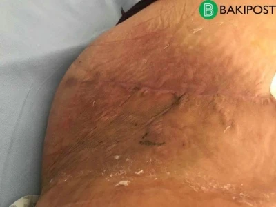 В Баку главврач частной клиники покалечил пациентку – ФОТО