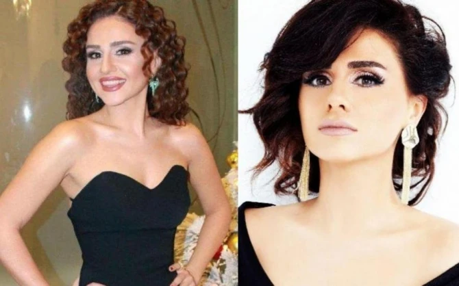 Məşhurlarımız plastik əməliyyatdan əvvəl - FOTOLAR