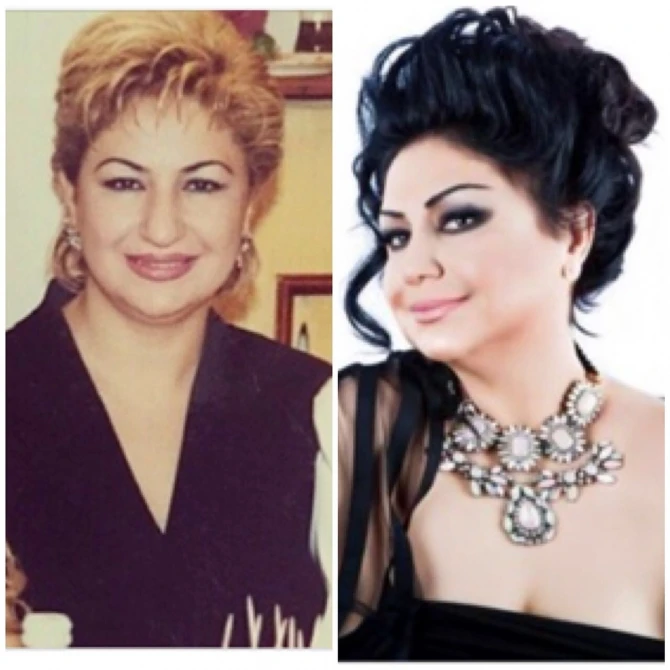 Məşhurlarımız plastik əməliyyatdan əvvəl - FOTOLAR