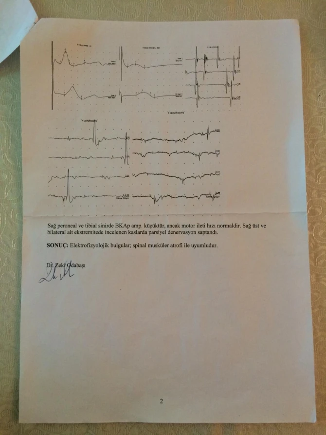 2 yaşlı körpənin xeyirxah insanlara ehtiyacı var – FOTO