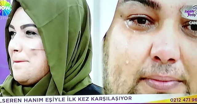 Saqqalı üzündən küçəyə çıxa bilməyən qadını görənlər şoka düşdülər - FOTO+VİDEO