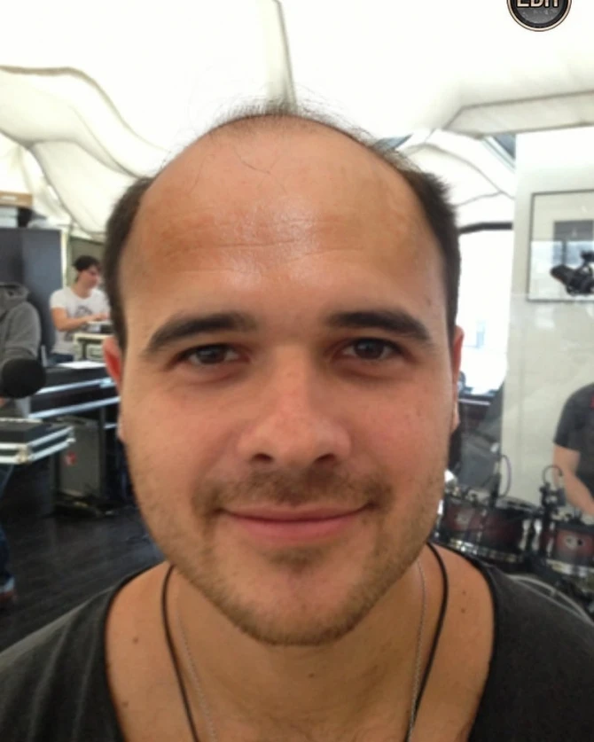 «Моя первая фотка без парика» - признание от Эмина (ФОТО)