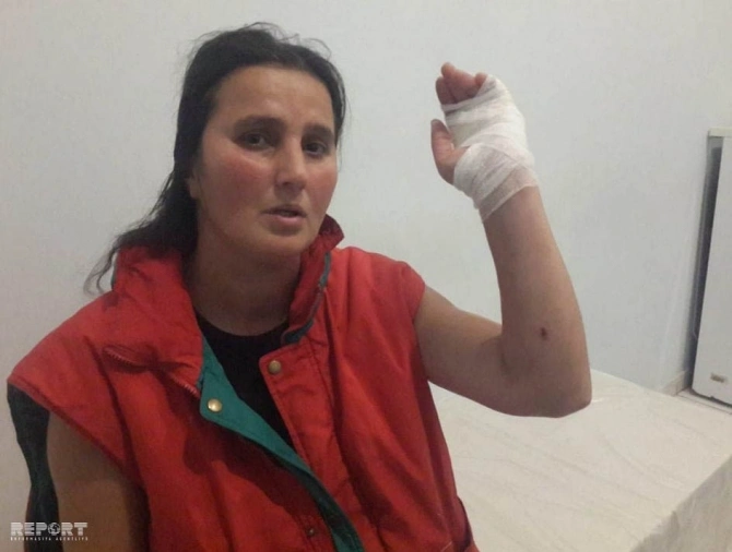 Sumqayıtda qonşu qadınlar arasında insident - FOTO