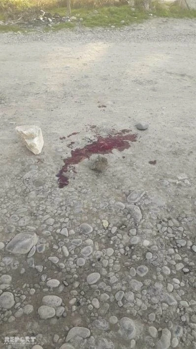 Azərbaycanda ŞOK HADİSƏ - Oğul anasını küçənin ortasında bıçaqladı - FOTO