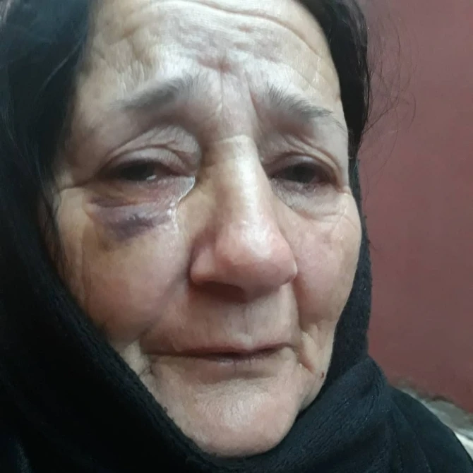 В Баку невестка избила свекровь – ФОТО