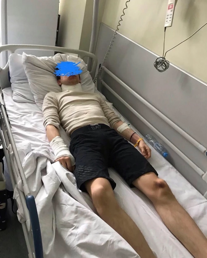 20-летнего парня, не пожелавшего поделиться своей девушкой, жестоко избили - ВИДЕО+ФОТО
