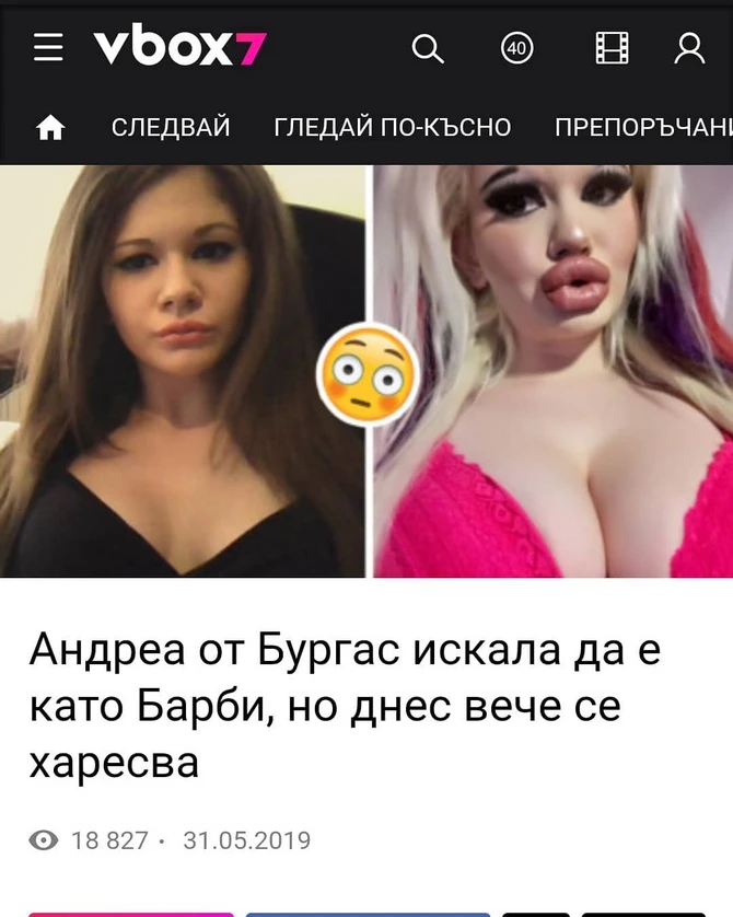 Студентка изуродовала себя, чтобы стать похожей на куклу Барби - ФОТО