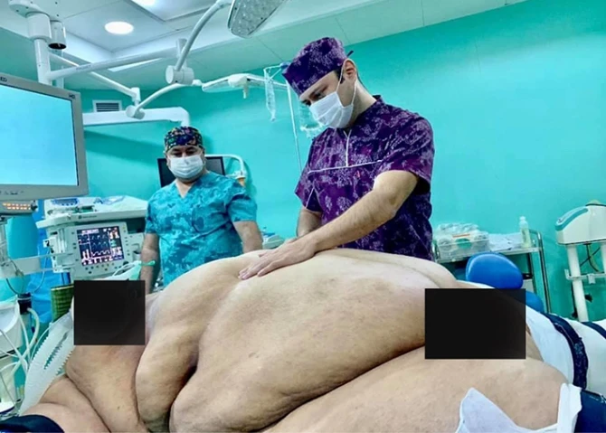 В Баку 256-килограммовой женщине сделали сложную операцию - ФОТО