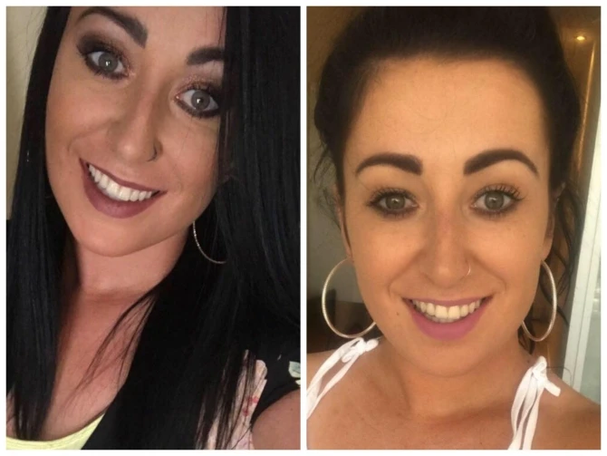 Девушка сделала селфи за несколько минут до инсульта, и это ФОТО спасло ей жизнь