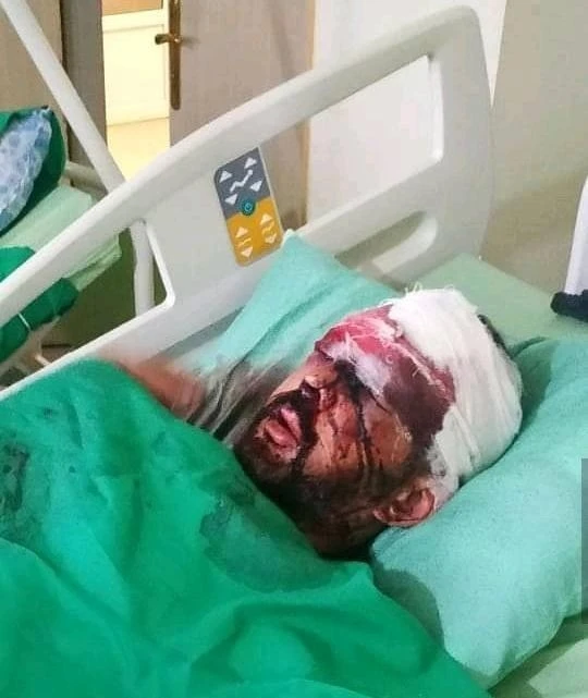 Müğənni Vüqar Muradovun qəzaya düşmə xəbəri yayıldı - DƏHŞƏTLİ FOTO