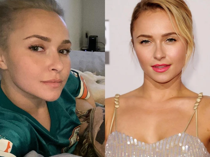 Бывшую девушку Кличко, которая родила ему дочь, избил новый бойфренд - ФОТО