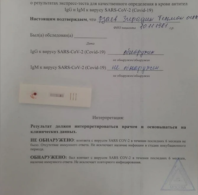 Zirəddin Rzayevdən koronavirus açıqlaması - FOTO