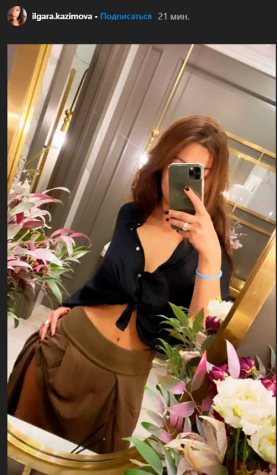 Xalq artistinin qızı plastik əməliyyatdan sonra - FOTO