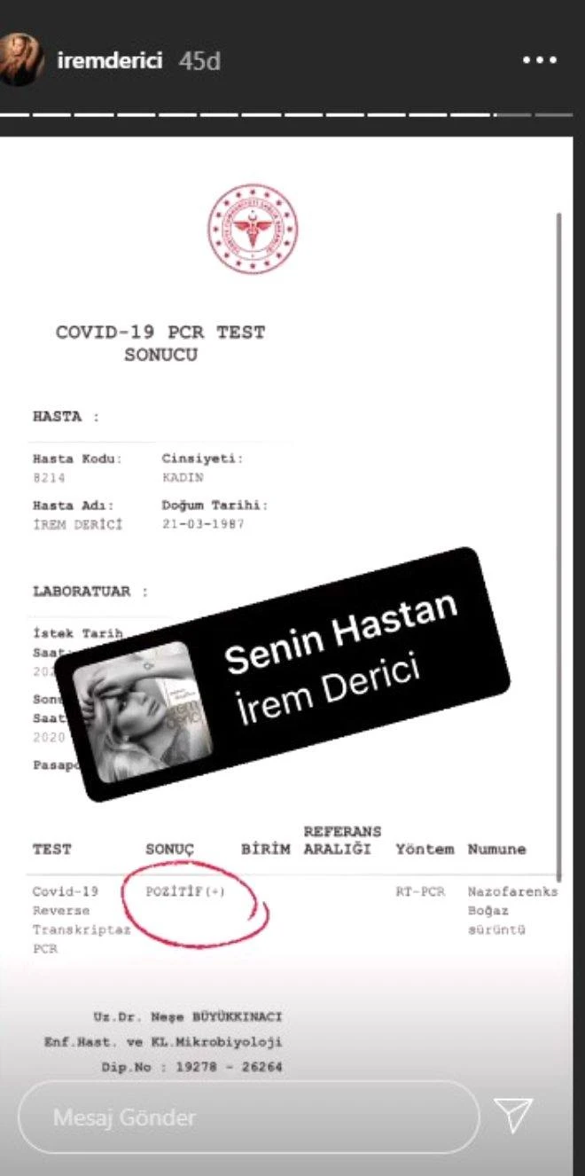 İrem Derici koronavirusa yoluxdu - FOTO