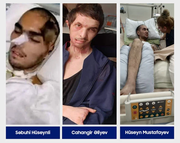 “YAŞAT”dan ağır vəziyyətdə olan üç qazimizlə bağlı vacib AÇIQLAMA - FOTO