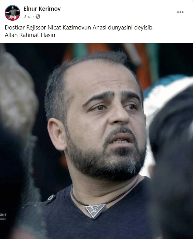 Azərbaycanın tanınmış əməkdar artistinə AĞIR İTKİ - FOTO