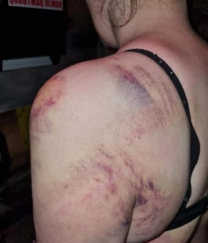 В Баку возбуждено уголовное дело в отношении избивавшего жену мужчины - ФОТО