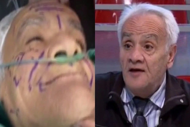 69 yaşlı əməkdar artist qarın piylərini üzünə vurdurdu - FOTO