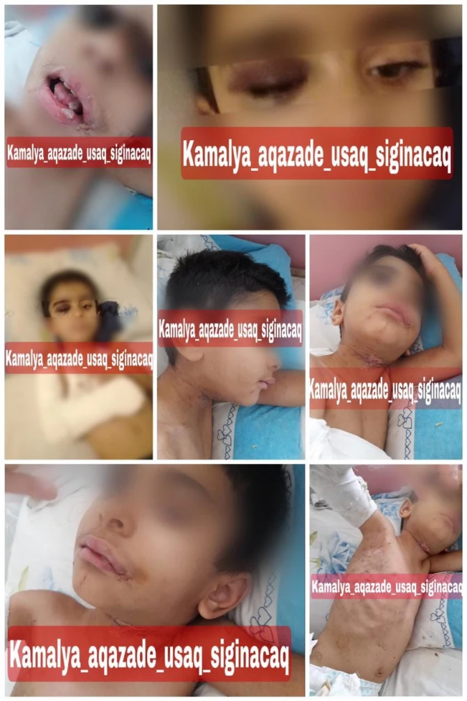 Prokurorluq sevgilisi ilə azyaşlı uşağının dilini qoparan ananın məsələsini nəzarətə götürdü - YENİLƏNİB - FOTO