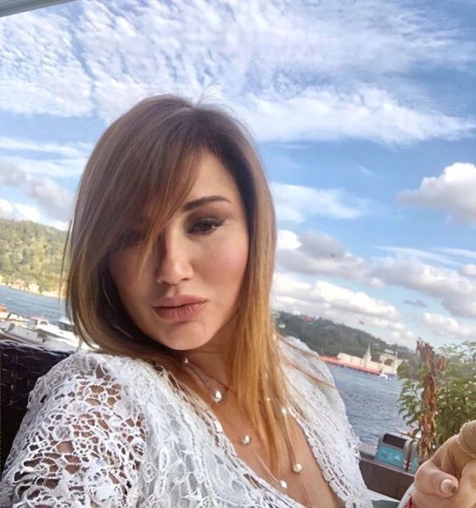Türkiyəli müğənni tanınmaz halda - FOTO