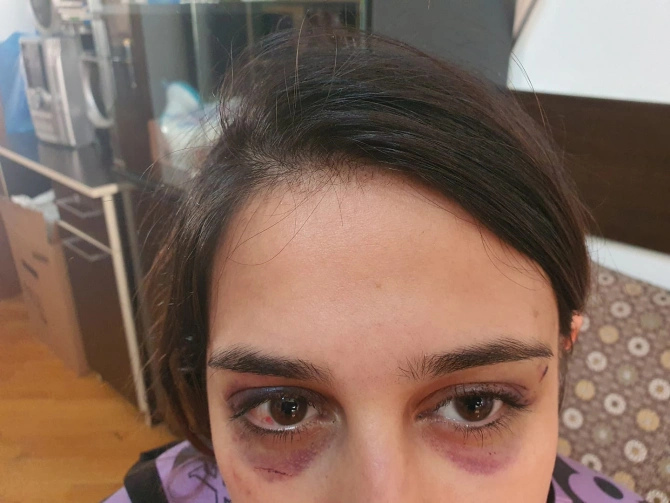 Azərbaycanda dəhşət! Əri hamilə qadını döyərək uşağını öldürmək istəyib - FOTO
