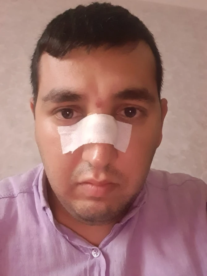 Bakıda rəis keçmiş işçisini kabinetində döydü - FOTO