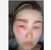 Bloger gözəllik salonundakı prosedurdan sonra tanınmaz hala düşdü - FOTO