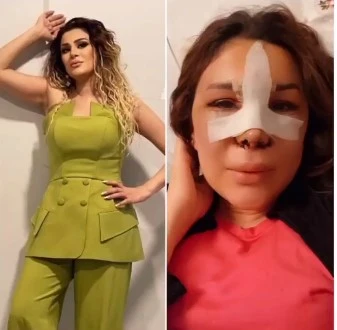 Azərbaycanlı müğənni 9 saatlıq əməliyyata girdi - FOTO