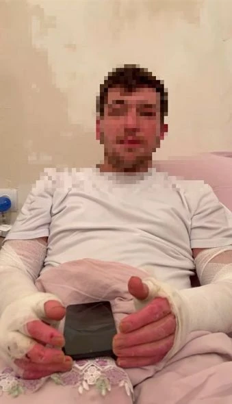 Пострадавший при взрыве в ночном клубе в Баку: Сказали, делай что хочешь - ФОТО