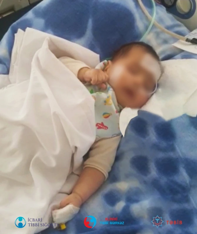 Bakıda bir həftə komada qalan 3 aylıq körpənin həyatı xilas edilib - FOTO