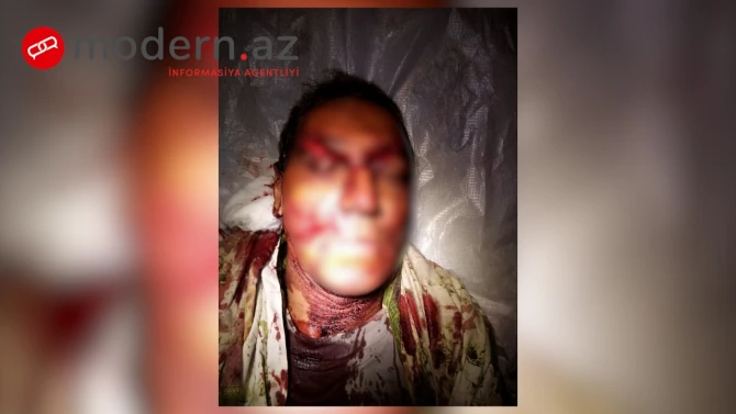 Ağsuda çobanı canavar parçaladı - FOTO