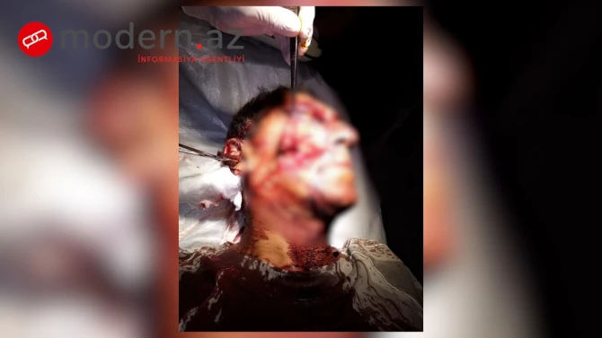 Ağsuda çobanı canavar parçaladı - FOTO