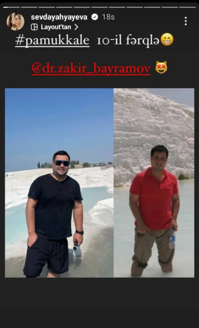 Sevda ərinin 10 il əvvəlki fotosunu paylaşdı - FOTO