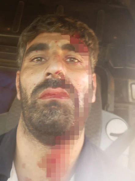 Bakıda avtobus xəttində şirkətin elektriki döyüldü - ŞİKAYƏT - FOTO