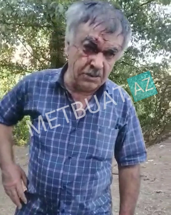 Ziyarətdən qayıdarkən qəzada həlak olan qadınların və sürücünün FOTOLARI