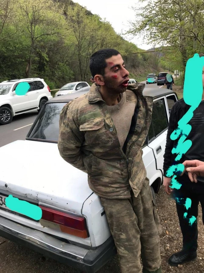Армяне пытали пропавшего без вести азербайджанского военнослужащего - ФОТО