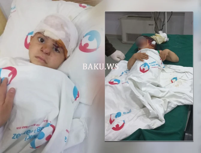 Sahibsiz itlər həyətdə oynayan uşaqlara hücum çəkdilər - İki uşaq ağır xəsarətlər alıb - FOTO