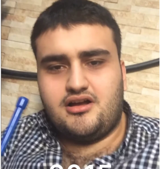 CZN Burakın 8 il əvvəlki görüntüsü TƏƏCCÜBLƏNDİRDİ - FOTO