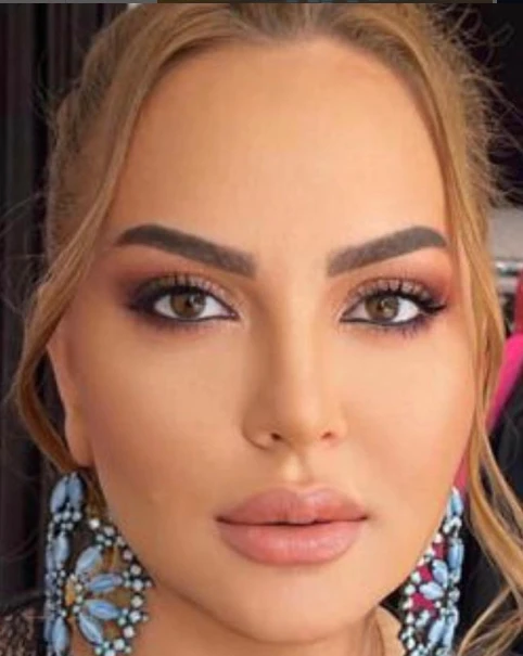 Azərbaycanlı model vəfat etdi - FOTO