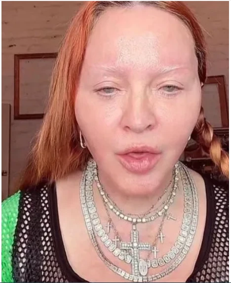 Madonnanın son görünüşü HƏR KƏSİ ŞOKA SALDI - FOTO